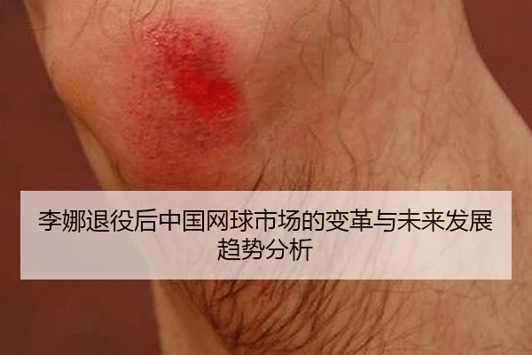 李娜退役后中国网球市场的变革与未来发展趋势分析